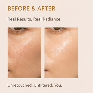 Zorviney® AirGlow Skin-Perfecting Foundation